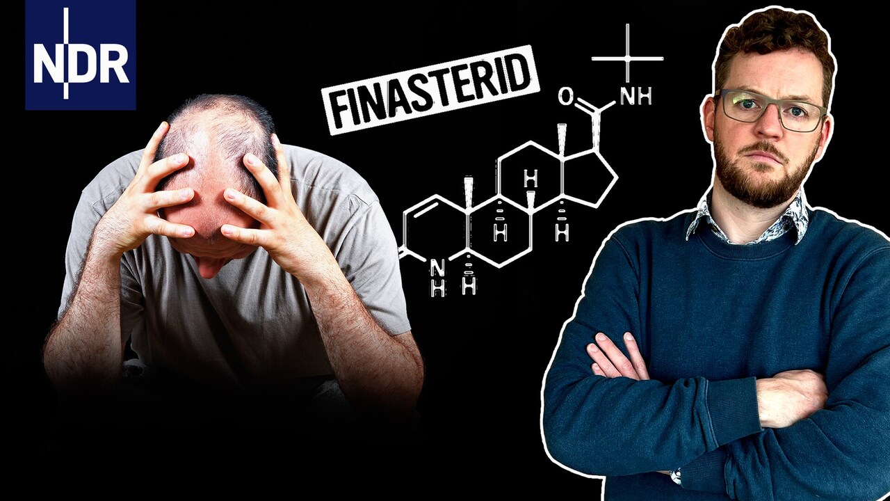 Finasteride kaufen deutschland